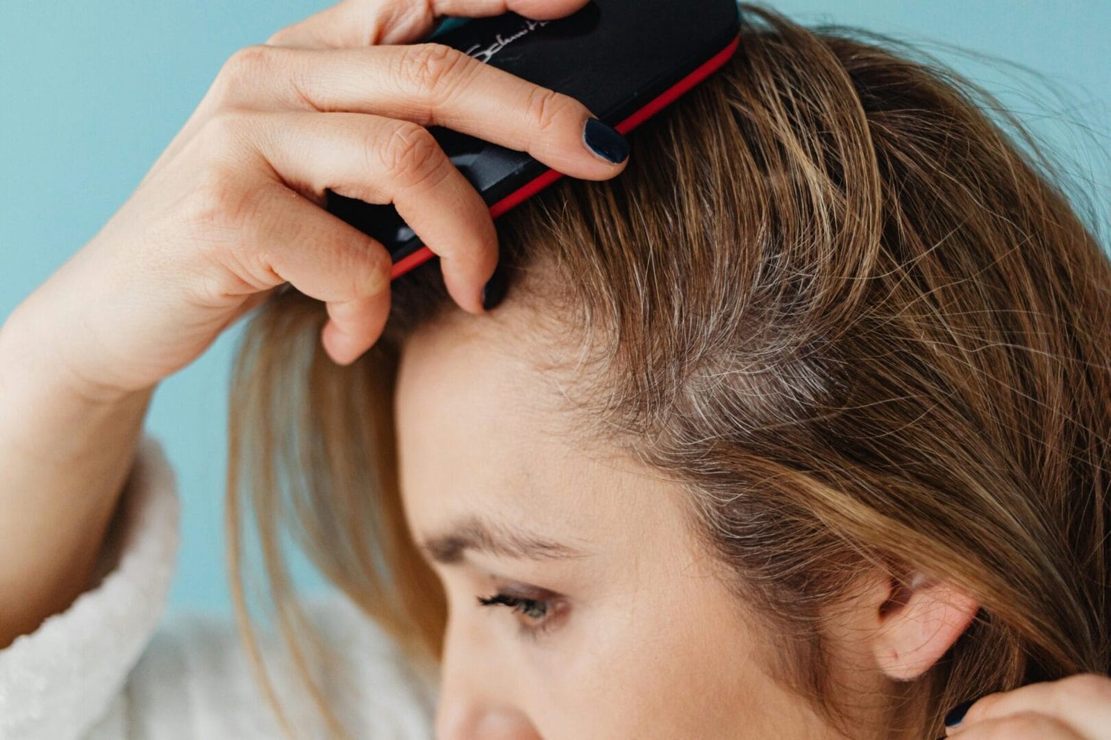 Scalp Psoriasis Treatment