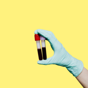 Tiredness & Fatigue Blood Test