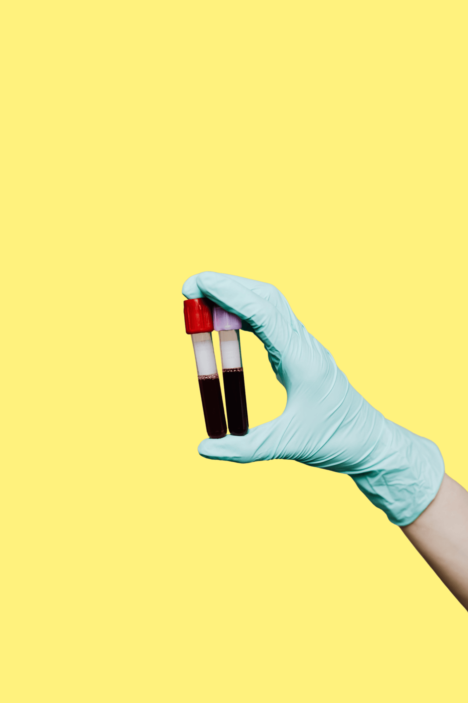 Tiredness & Fatigue Blood Test