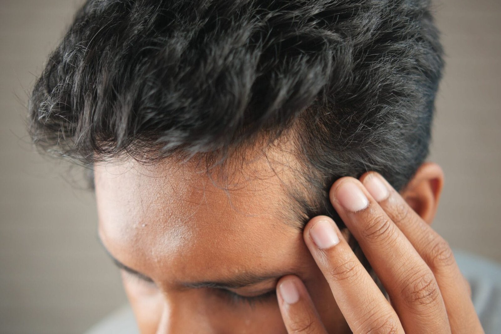 What Causes Male Pattern Baldness? Understanding DHT and Hair Loss