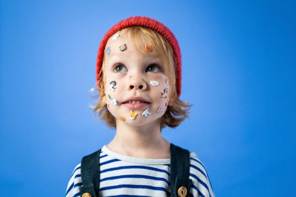 Everything You Need to Know About Impetigo at The Kingston Pharmacy, Kingston upon Thames