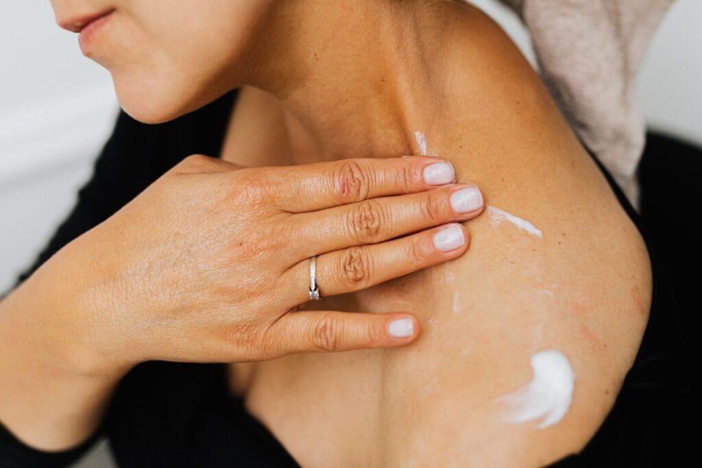 The Different Types of Dermatitis Explained at The Kingston Pharmacy, Kingston upon Thames