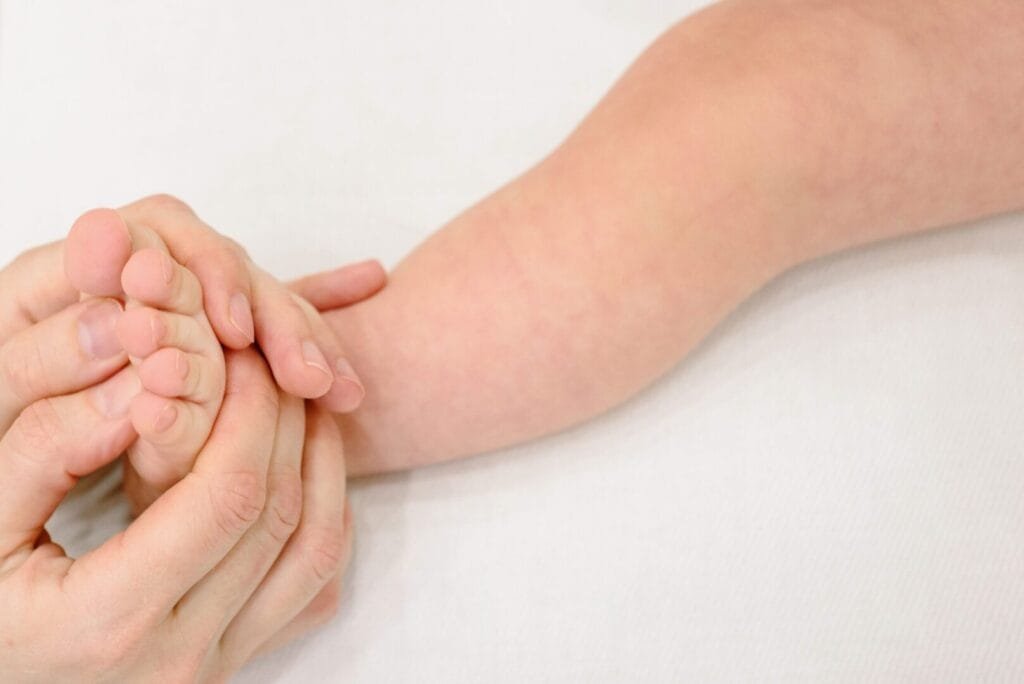 Measles Is Back: Why MMR Vaccination Matters More Than Ever at The Kingston Pharmacy, Kingston upon Thames