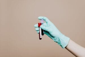 What Can a Private Blood Test Detect? at The Kingston Pharmacy, Kingston upon Thames